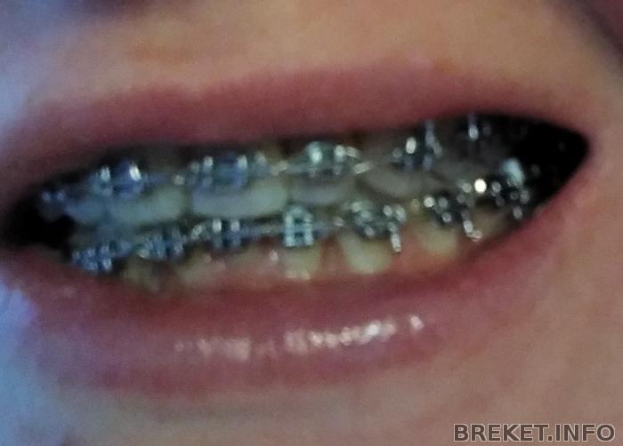 p_20190122_102125_p_1.jpg