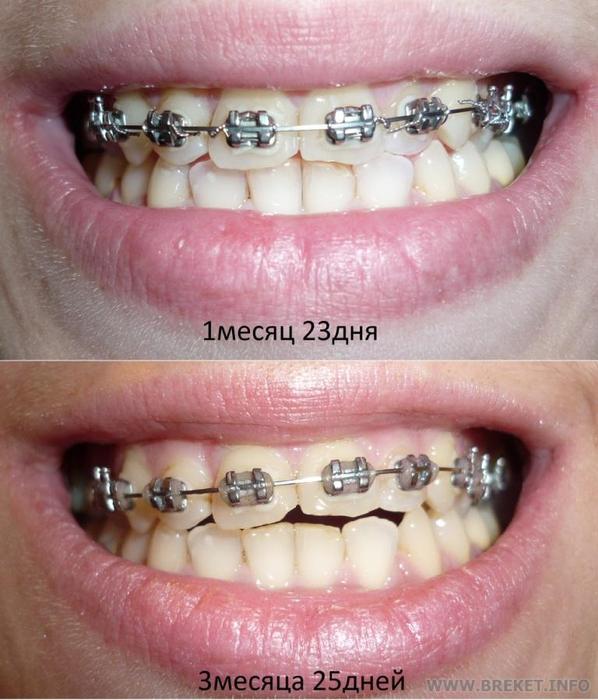 dinamika2.jpg "кто в лес, кто по дрова"