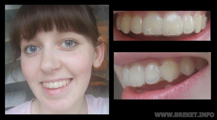 • Капа на мне. ) •