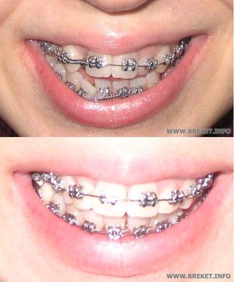 Двойка встала в ряд!