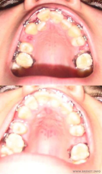 Прогресс,вид снизу