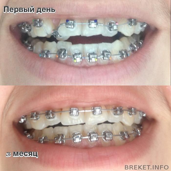 Динамика за 3 месяца