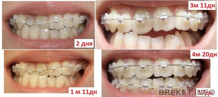 sravnenie_4m_20dney_-_1.jpg