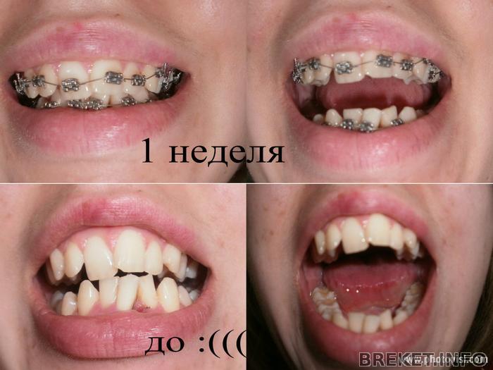 1 неделя.jpg