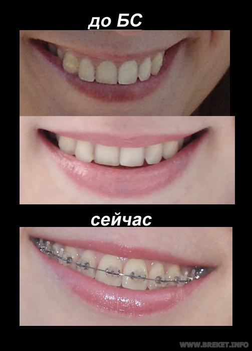 do-poslie.jpg до и сейчас