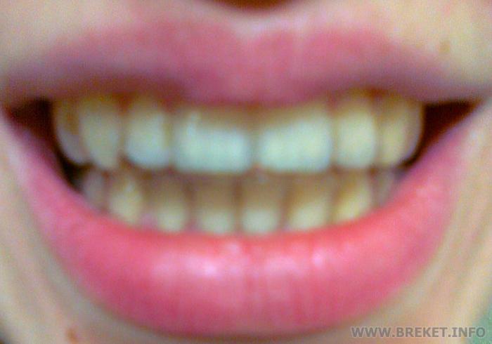 А вот и результат :)