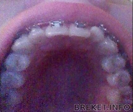 img_20140412_224437.jpg