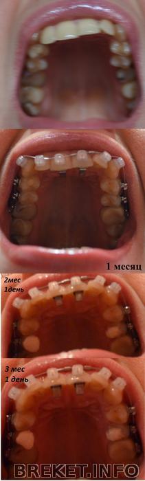 vch_3_mesyaca_1_den.jpg