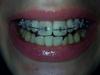 img-20141121-wa0004.jpg