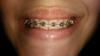 img_20141015_203841.jpg
