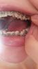 20150120_102517.jpg