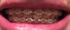 after_12m_2.png
