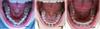 nch_sravn_1d_6m_11m.jpg