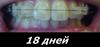 18 дней ) 