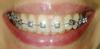 zub4.jpg