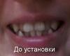 До установки.jpg
