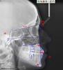orthodontia_clip_image022_0000.jpg