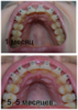 vverh_55_mesyacev_sravnenie.png