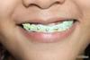 460px-make-fake-braces-or-a-fake-retainer-step-9.jpg