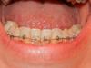 rscn34691.jpg