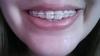 20140521_194729.jpg