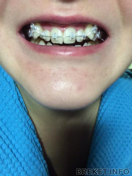 429b13b6-8592-4fb9-b5a4-57977f86a389.jpeg 429b13b6-8592-4fb9-b5a4-57977f86a389.jpeg