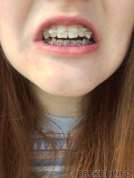 0dc52138-96d9-4706-b100-672343b87177.jpeg 0dc52138-96d9-4706-b100-672343b87177.jpeg