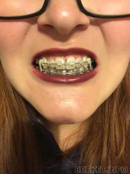 82709e5c-3d43-48c3-a502-35a9dde56838.jpeg 82709e5c-3d43-48c3-a502-35a9dde56838.jpeg