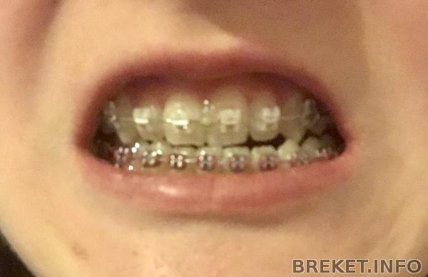 0d971324-d70a-4a2d-9155-9036eeac58ca.jpeg 0d971324-d70a-4a2d-9155-9036eeac58ca.jpeg