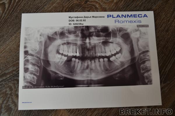 оптг снимок.jpg