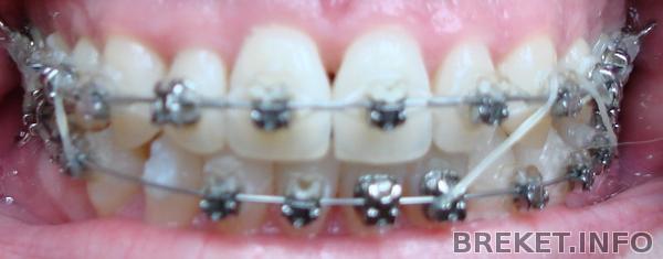 треугольник