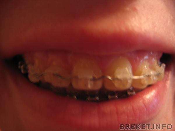 img_3058.jpg img_3058.jpg