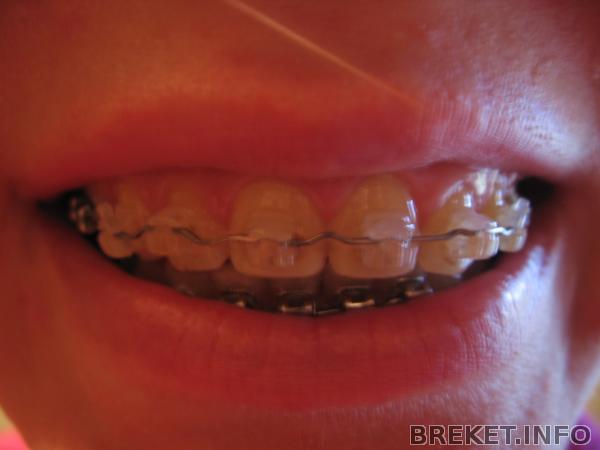 img_3057.jpg img_3057.jpg