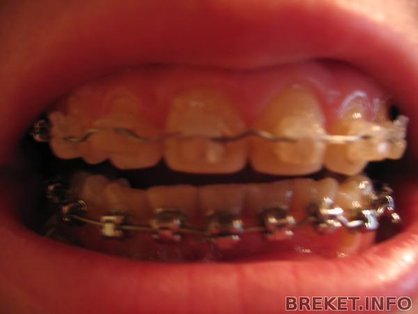 img_3059.jpg img_3059.jpg