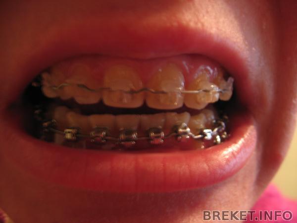 img_3061.jpg img_3061.jpg