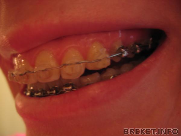 img_3068.jpg img_3068.jpg