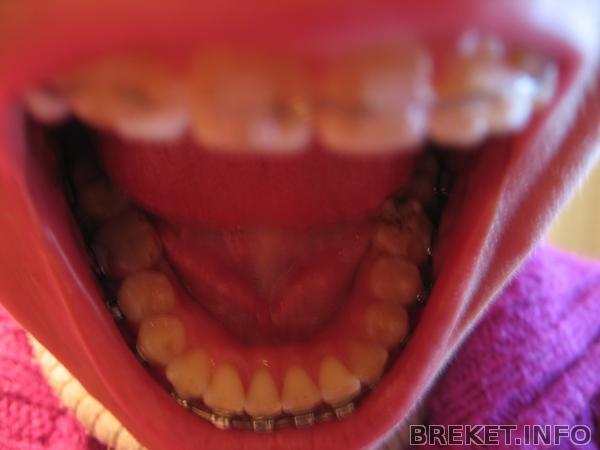 img_3047.jpg img_3047.jpg