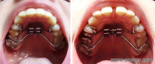 nord_2weeks.jpg nord_2weeks.jpg