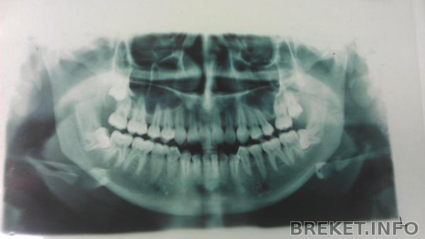 optg_do.jpg optg_do.jpg