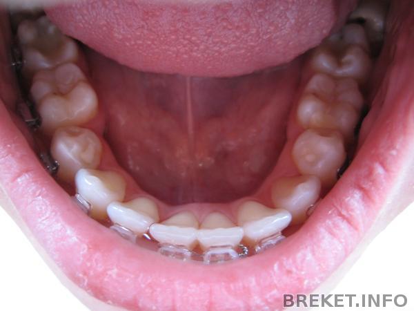 img_2028.jpg img_2028.jpg