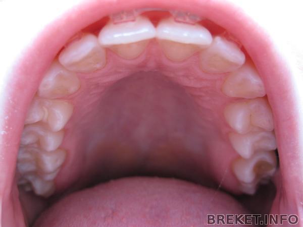 img_2029.jpg img_2029.jpg