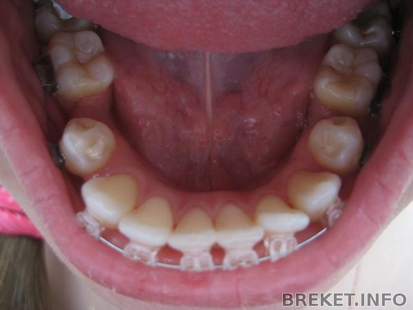 izobrazhenie_014.jpg izobrazhenie_014.jpg