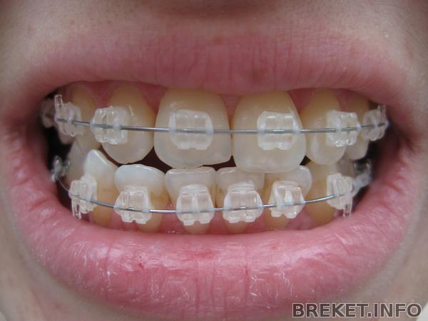 izobrazhenie_017.jpg прикус