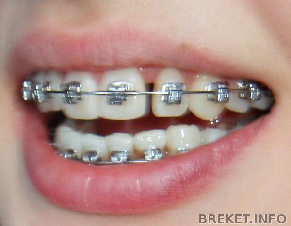 shchel_11_mes.jpg shchel_11_mes.jpg