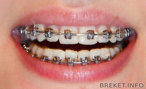 1g2mes.jpg 1g2mes.jpg