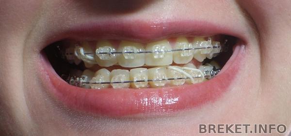 9 месяцев.jpg