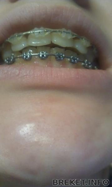 imag1108.jpg imag1108.jpg