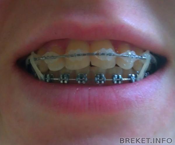 img_20130314_094457.jpeg img_20130314_094457.jpeg