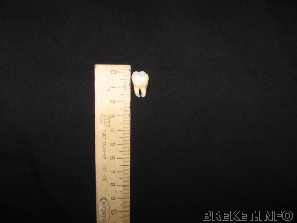 прощай мудрость