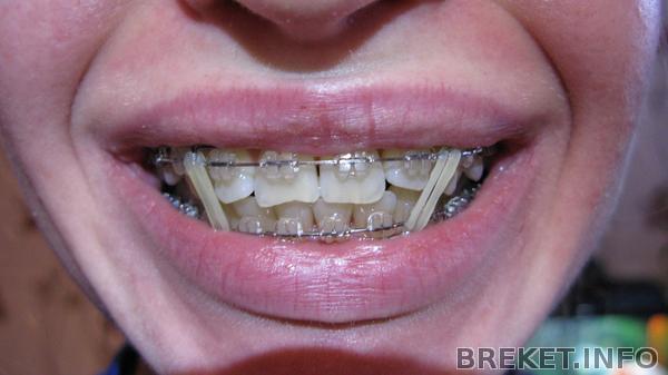 год и месяц